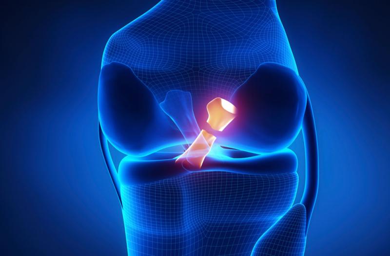 Cruciate Ligament Diagnosis And Treatment Market Growth