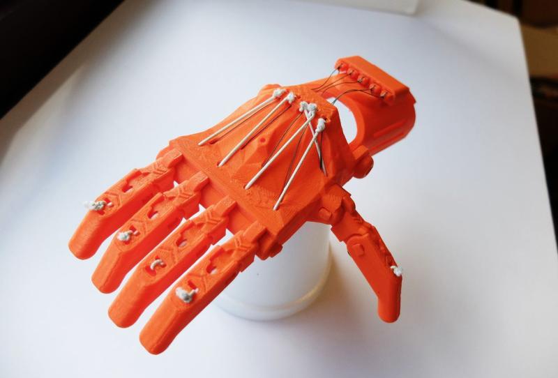 3D Printed Prosthetics Market Shows Strong Expansion | 3D
