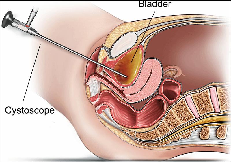 Organ Care System Market to Witness Stunning Growth to Generate