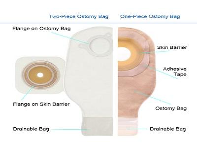 Ostomy Drainage Bags Market  Global Analysis Report 2031