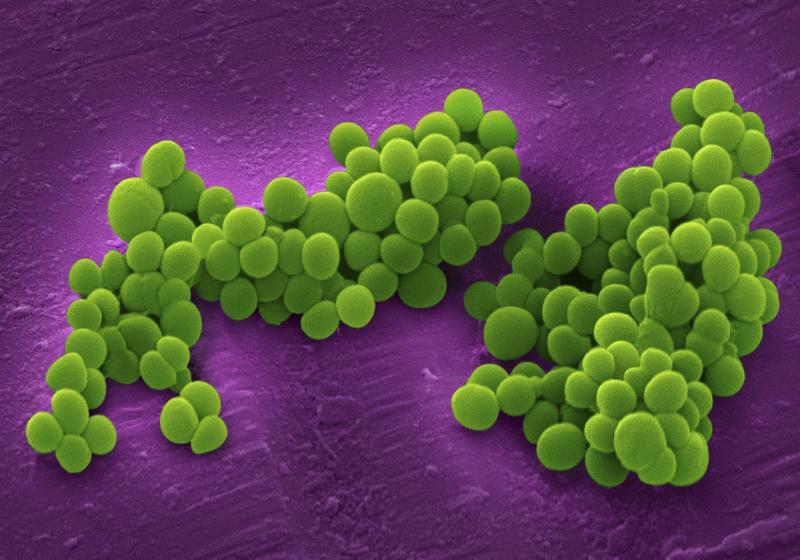 Methicillin-resistant Staphylococcus Aureus (MRSA) Drugs Market, Methicillin-resistant Staphylococcus Aureus Drugs Market Size