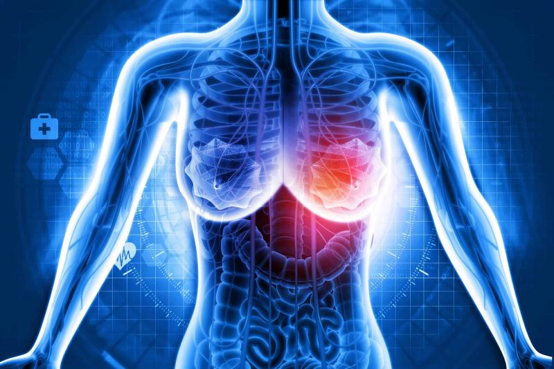 Breast Cancer Therapeutics Market, Breast Cancer Therapeutics Market Size, Breast Cancer Therapeutics Market Share