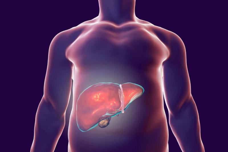 Non-alcoholic Steatohepatitis (NASH) Biomarkers Market, Non-alcoholic Steatohepatitis (NASH) Biomarkers Market size