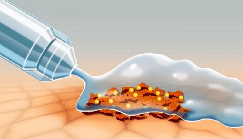 Wound Irrigation Systems Market, Wound Irrigation Systems Market Size, Wound Irrigation Systems Market Share