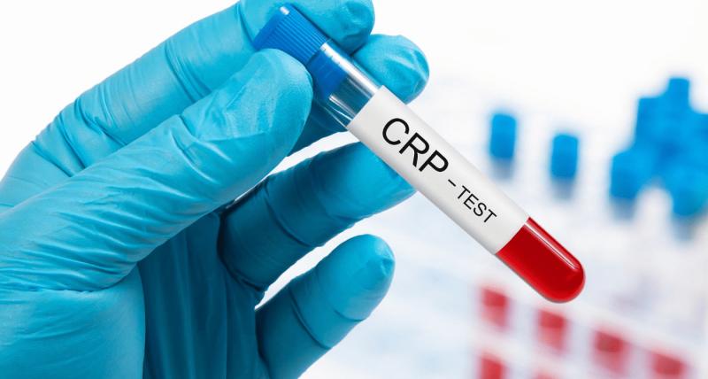 C-reactive Protein Testing Market, C-reactive Protein Testing Market Size, C-reactive Protein Testing Market Share