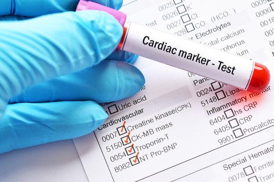 Cardiac Marker Testing Market Size to be Worth USD 11.59 Billion