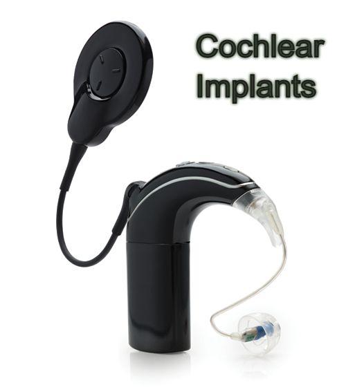 Cochlear Implants Industry