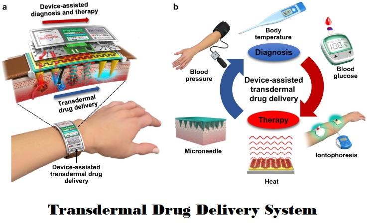 Transdermal Drug Delivery System Market