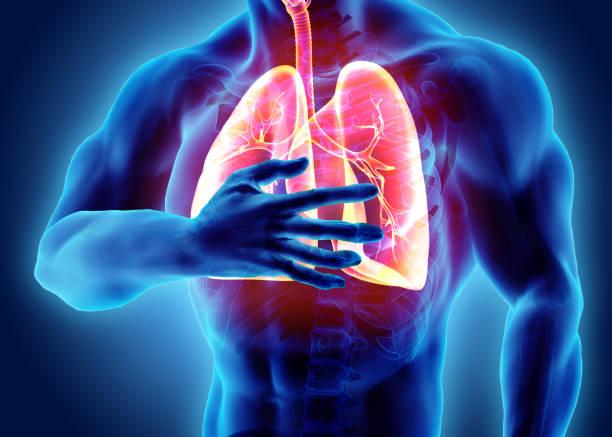 North America Acute Lung Injury Market