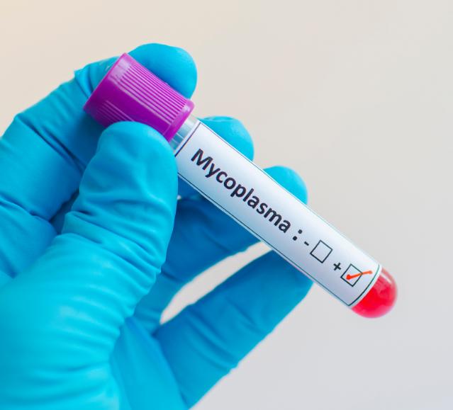Global Mycoplasma Testing Market