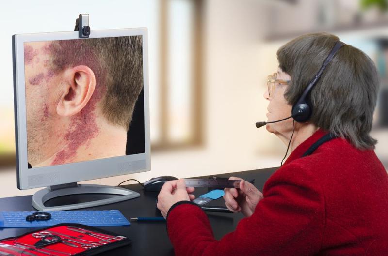 Tele Dermatology Market