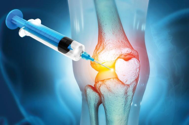 Knee Cartilage Regeneration Treatment