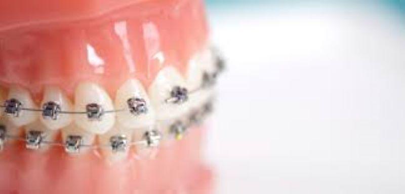 Orthodontic Services