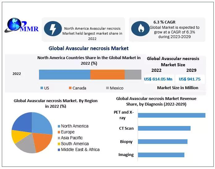 Avascular Necrosis Market