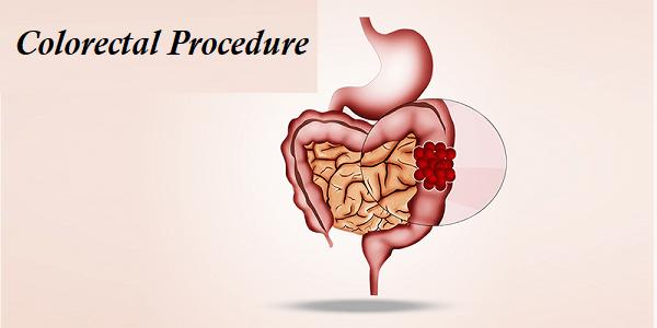 Colorectal Procedure