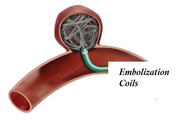 Embolization Coils