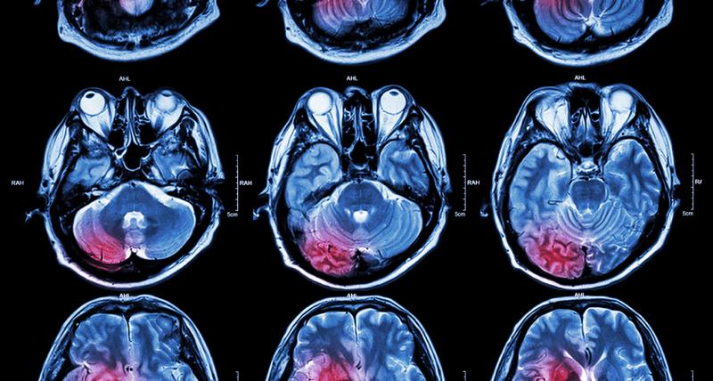 Global Cancer Diagnostics Market is anticipated to create a value opportunity of around USD 43.7 billion by 2031 - FUJIFILM Corporation, Danaher Corporation, AMOY Diagnostics CO. LTD, Exact Science