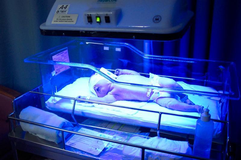 Phototherapy Market Expected to Exceed $564.9 million By 2030