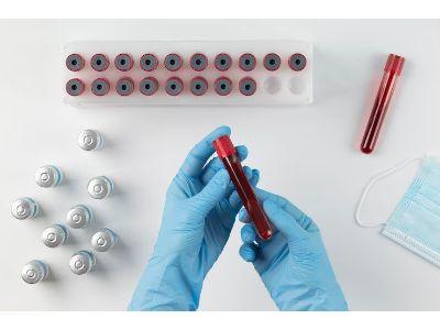 Hemoglobin Testing Market 2023 Manufacturer Landscape,