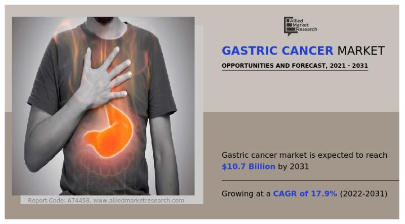 Global Gastric Cancer Market Analysis: Current Trends
