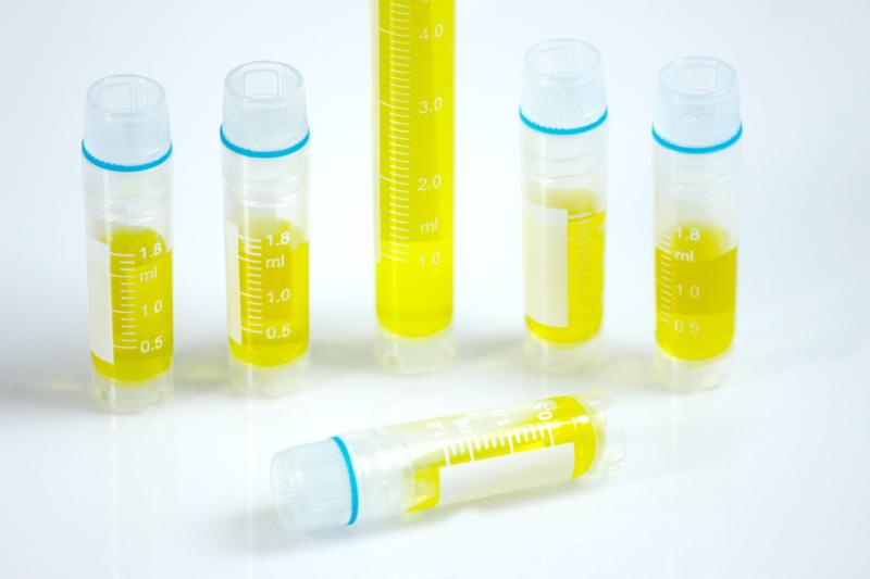 Cryogenic Vials Market