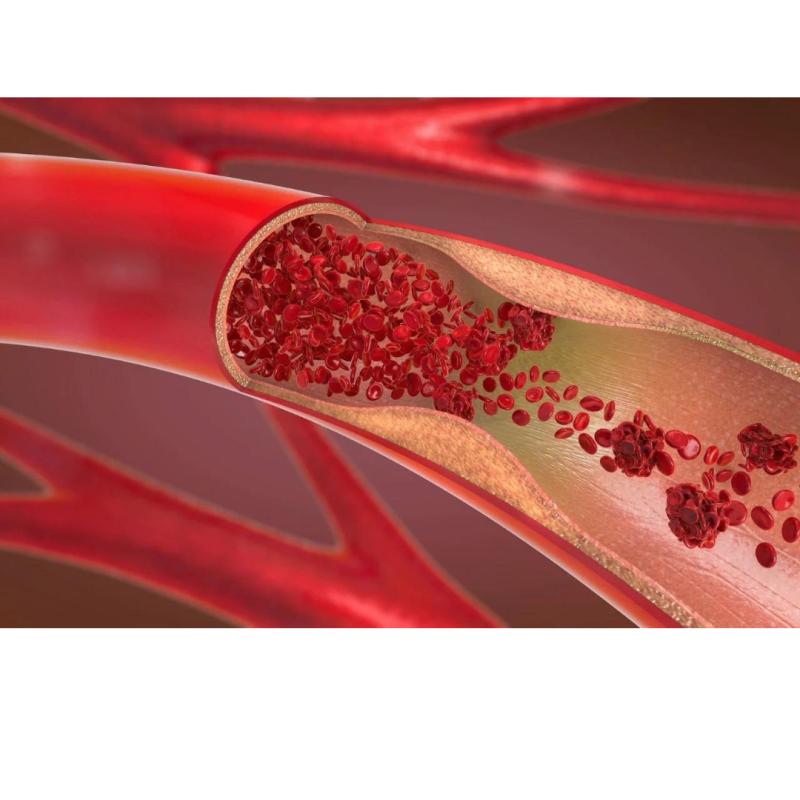 Vascular Injury Treatment Market