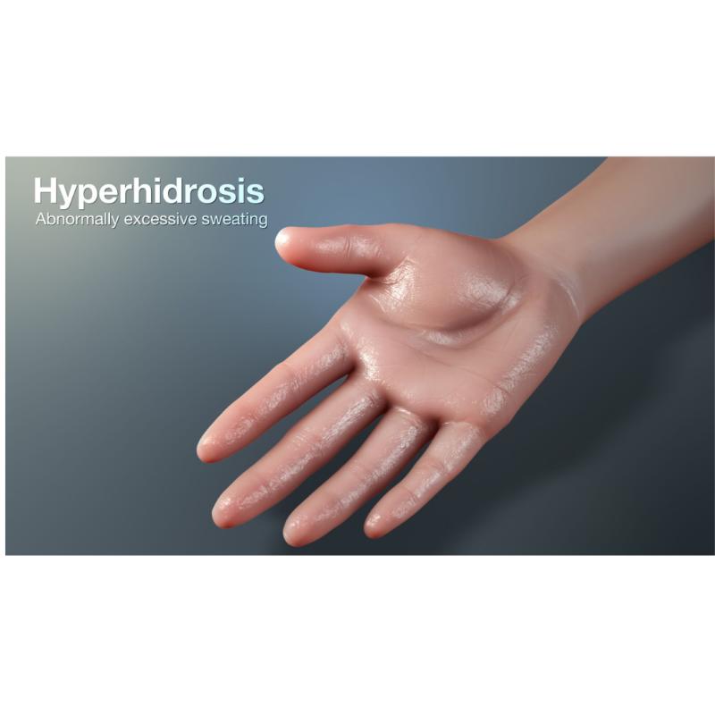 Hyperhidrosis Treatment Market