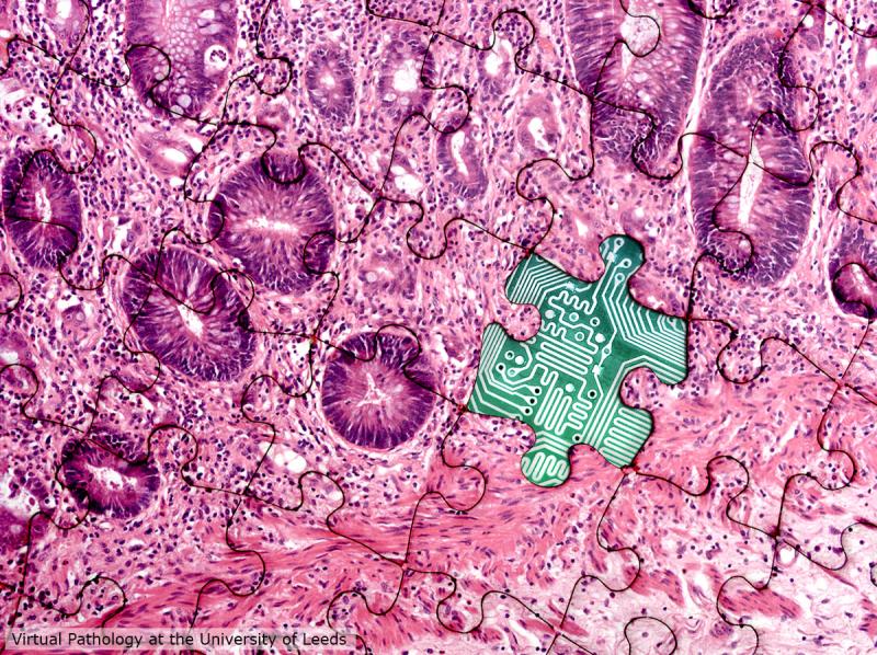 AI in Digital Pathology Market Set to Witness an Uptick during