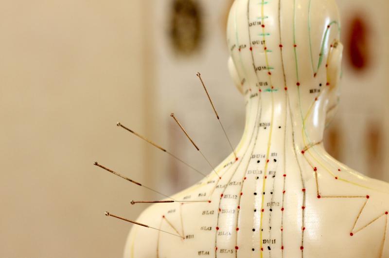 Acupuncture Market 2023-2031