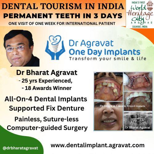 Dr. Agravat One Day Dental Implants Redefines Dental Tourism Heritage City Ahmedabad India Experience