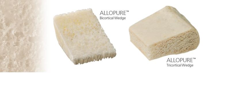 Bone Allografts Market