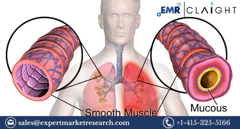 Bronchial Spasms Treatment Market: A Comprehensive Overview