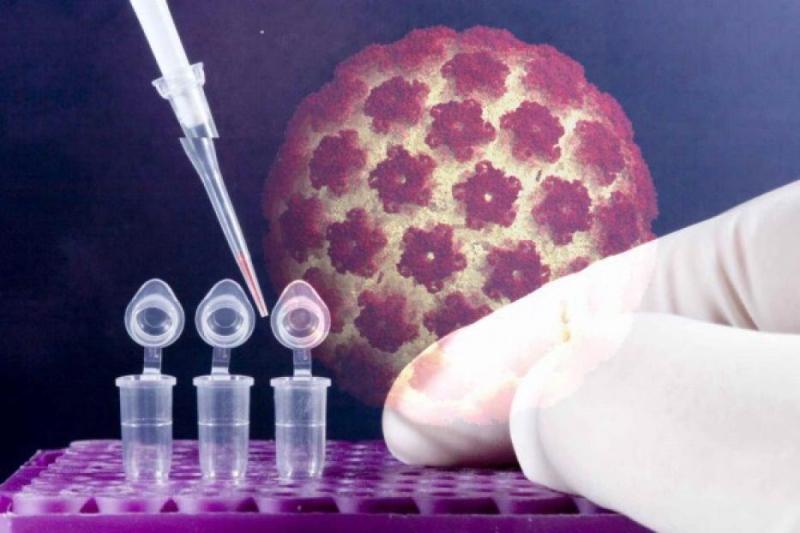 Cytology and HPV Testing Market to Reach US$ 12.54 bn by 2027