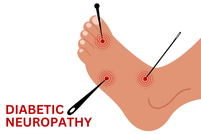 Diabetic Peripheral Neuropathy Market Report 2023-2033 |