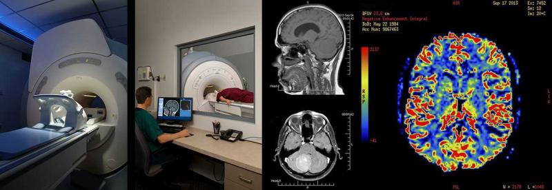 Photoacoustic Tomography Market To Reach USD 3.2 Billion