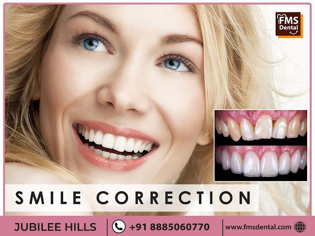 Smile Correction Tips By FMS Dental Hospital to Maintain