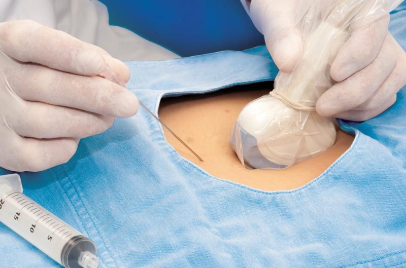 Soft Tissue Ultrasound Surgery System Market : Latest Trends,