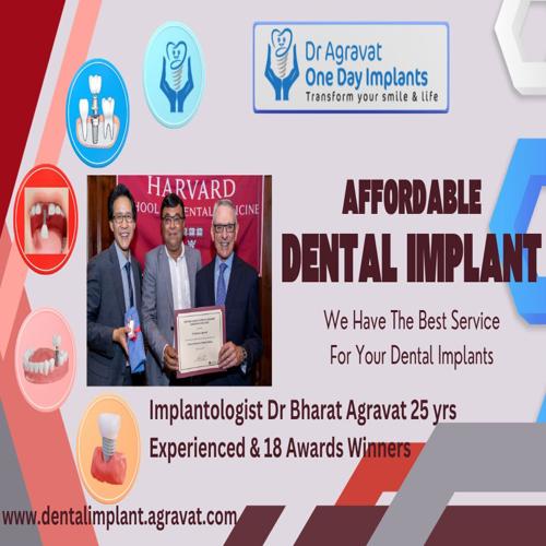 Affordable Dental Implants Cost in Ahmedabad Gujarat India: Exploring Price Factors for Quality Dental Implants Surgery.