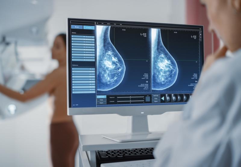 China Cancer Screening Market Trends Point towards Growth