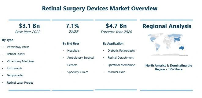 Booming segments of the Retinal Surgery Devices Market ; Investors looking for growth | Escalon, Iridex, Alcon