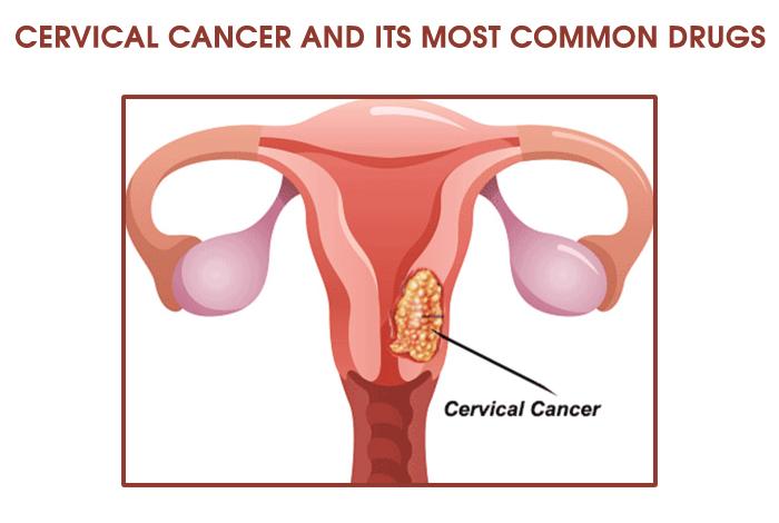 Cervical Cancer Drugs Market Size, Share, Competitive