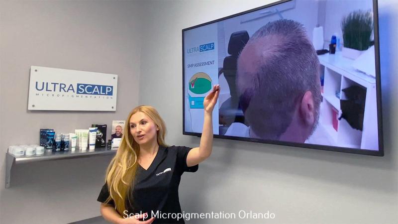 Ultra Scalp Micropigmentation Outlines the Aftercare Process