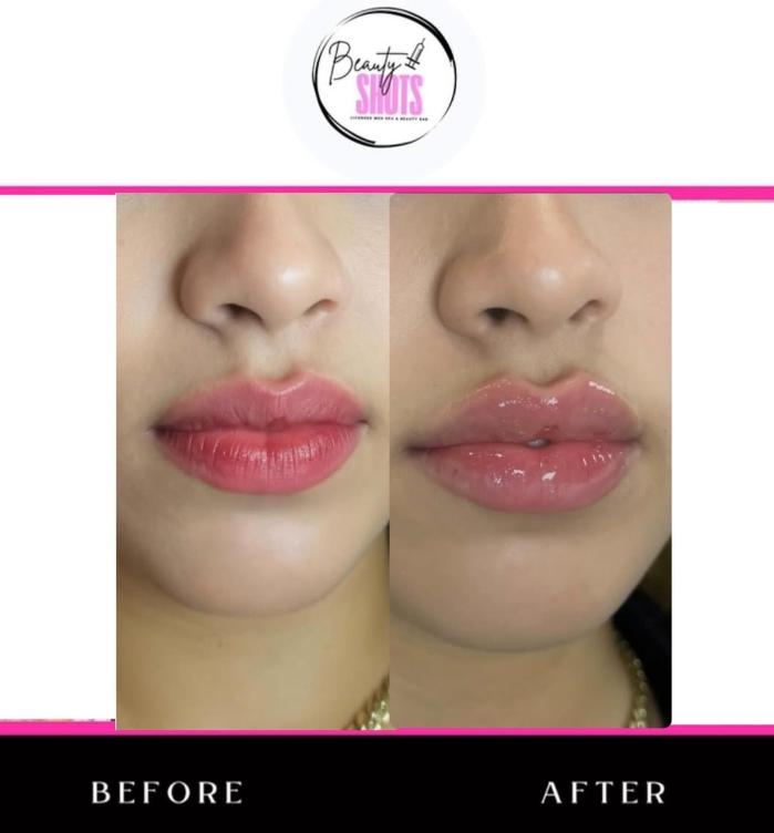 Beauty Shots NOVA Redefines Non-Surgical Body Contouring in Northern Virginia