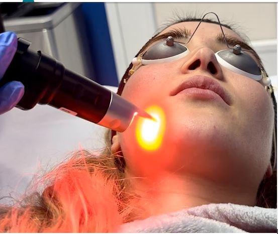 Blue Medical Spa - Transform Look with Expert Cheek Filler Services in Sherman Oaks, CA.